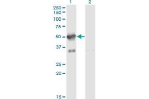 Western Blotting (WB) image for anti-A Kinase (PRKA) Anchor Protein 17A (AKAP17A) (AA 53-157) antibody (ABIN599035) (SFRS17A Antikörper  (AA 53-157))