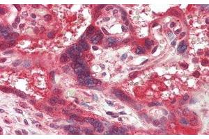 Detection of TF in Human Placenta Tissue using Monoclonal Antibody to Tissue Factor (TF) (Tissue factor Antikörper  (AA 30-252))