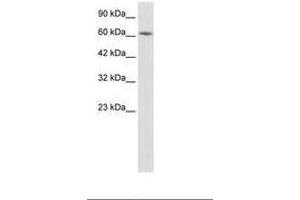 Image no. 1 for anti-Kelch-Like 28 (KLHL28) (AA 380-429) antibody (ABIN202773) (KLHL28 Antikörper  (AA 380-429))