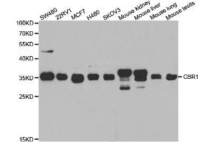 Western blot analysis of extracts of various cell lines, using CBR1 antibody (ABIN5973163) at 1/1000 dilution. (CBR1 Antikörper)