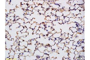 Immunohistochemistry (IHC) image for anti-Protein Kinase, CGMP-Dependent, Type I (PRKG1) antibody (ABIN720221)