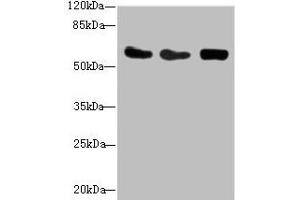 Western blot All lanes: CSRNP2 antibody at 2. (CSRNP2 Antikörper  (AA 324-543))