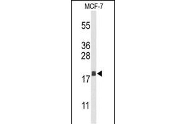 AGR3 Antikörper  (C-Term)