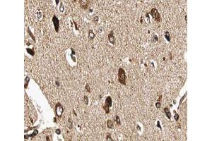 ABIN6266907 at 1/100 staining human brain tissue sections by IHC-P. (GUCY1B3 Antikörper  (N-Term))