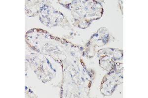 Immunohistochemistry of paraffin-embedded human placenta using SPON2 antibody (ABIN6129679, ABIN6148370, ABIN6148372 and ABIN6215647) at dilution of 1:100 (40x lens). (SPON2 Antikörper  (AA 27-150))