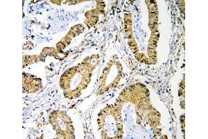 IHC analysis of PRMT1 using anti-PRMT1 antibody (ABIN7599706).