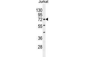 ZNF648 Antibody (N-term) western blot analysis in Jurkat cell line lysates (35 µg/lane). (ZNF648 Antikörper  (N-Term))