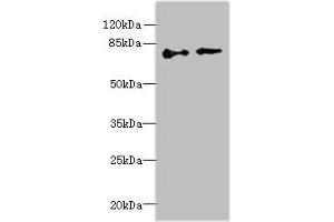 Western blot All lanes: ECD antibody at 6 μg/mL Lane 1: Hela whole cell lysate Lane 2: U251 whole cell lysate Secondary Goat polyclonal to rabbit IgG at 1/10000 dilution Predicted band size: 73, 68, 77 kDa Observed band size: 73 kDa (ECD/SGT1 Antikörper  (AA 1-300))