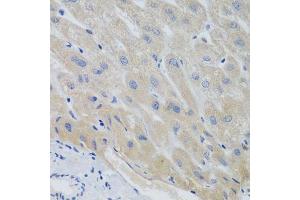 Immunohistochemistry of paraffin-embedded human liver using PTTG1 antibody. (PTTG1 Antikörper  (AA 1-202))
