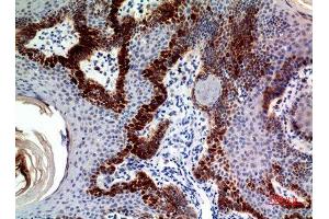 Immunohistochemistry (IHC) analysis of paraffin-embedded Human Skin, antibody was diluted at 1:100. (CLEC11A Antikörper)