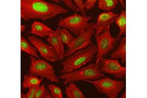 IF analysis of IRF9 using anti-IRF9 antibody (ABIN4886637) and anti-Tubulin Alpha antibody (ABIN7600339).