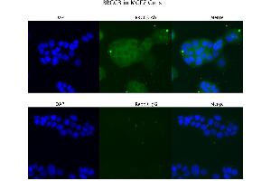 Sample Type: MCF7 Primary Antibody Dilution: 4 µg/mL Secondary Antibody: Anti-rabbit Alexa 546 Secondary Antibody Dilution:  µg/mL   Gene Name: BRCC3 (BRCC3 Antikörper  (C-Term))