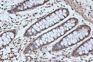 Immunohistochemistry of paraffin-embedded human colon using SRSF3 Rabbit mAb (ABIN7270216) at dilution of 1:100 (40x lens). (SRSF3 Antikörper)