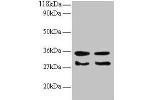 Western blot All lanes: TGFA antibody at 2 μg/mL Lane 1: EC109 whole cell lysate Lane 2: 293T whole cell lysate Secondary Goat polyclonal to rabbit IgG at 1/15000 dilution Predicted band size: 18, 17 kDa Observed band size: 30, 35 kDa (TGFA Antikörper  (AA 40-89))