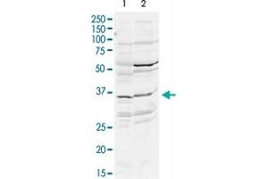 Western Blot analysis of mouse WT brain (A) and rat brain (B) tissue lysates with DLX2 polyclonal antibody  at 2 ug/mL working concentration. (DLX2 Antikörper  (N-Term))