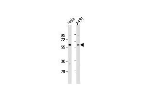 All lanes : Anti-Beclin-1 Antibody  at 1:4000 dilution Lane 1: Hela whole cell lysate Lane 2: A431 whole cell lysate Lysates/proteins at 20 μg per lane.