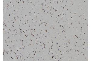 ABIN6273594 at 1/100 staining Rat heart tissue by IHC-P. (BCL11B Antikörper  (Internal Region))