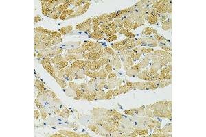 Immunohistochemistry of paraffin-embedded rat heart using RALBP1 antibody (ABIN5970488) at dilution of 1/100 (40x lens). (RALBP1 Antikörper)