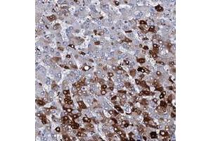 Immunohistochemical staining of human liver with C1orf68 polyclonal antibody  shows strong cytoplasmic positivity in subset of hepatocytes at 1:50-1:200 dilution.