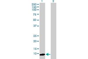 Western Blot analysis of ARL9 expression in transfected 293T cell line by ARL9 MaxPab polyclonal antibody. (ARL9 Antikörper  (AA 1-123))