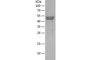 Western Blotting (WB) image for Moesin (MSN) (AA 410-577) protein (His-IF2DI Tag) (ABIN7124012) (Moesin Protein (MSN) (AA 410-577) (His-IF2DI Tag))