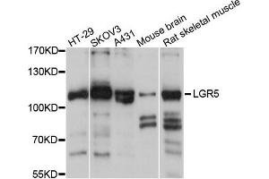 Western blot analysis of extracts of various cells, using LGR5 antibody. (LGR5 Antikörper)