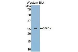 Detection of Recombinant CTSK, Simian using Monoclonal Antibody to Cathepsin K (CTSK) (Cathepsin K Antikörper  (AA 116-329))