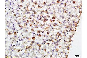 Formalin-fixed and paraffin embedded rat liver labeled with Anti-PCK2 Polyclonal Antibody, Unconjugated (ABIN708206) at 1:200 followed by conjugation to the secondary antibody and DAB staining (PEPCK Antikörper  (AA 365-470))