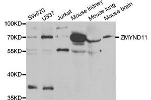 Western Blotting (WB) image for anti-Zinc Finger, MYND-Type Containing 11 (ZMYND11) antibody (ABIN1980343) (ZMYND11 Antikörper)