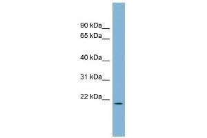 WB Suggested Anti-C4orf28 Antibody Titration: 0. (PACRGL Antikörper  (Middle Region))