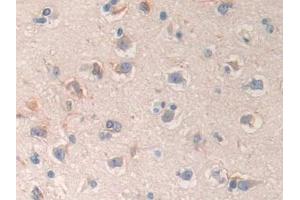 Immunohistochemistry (IHC) image for anti-C-Type Lectin Domain Family 4, Member M (CLEC4M) (AA 242-399) antibody (ABIN7441907)