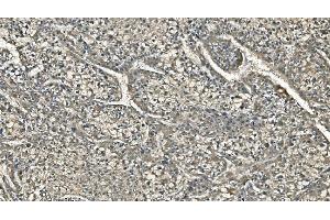 IHC analysis of Carbonic Anhydrase I/CA1 using anti-Carbonic Anhydrase I/CA1 antibody (ABIN7602621). (CA1 Antikörper  (AA 9-261))