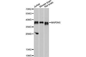 Western blot analysis of extracts of various cell lines, using MAP2K6 antibody. (MAP2K6 Antikörper)