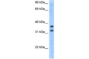 WB Suggested Anti-KCNRG Antibody Titration:  2.