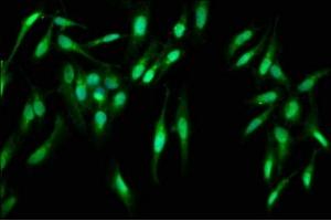 Immunofluorescence staining of Hela cells with ABIN7146938 at 1:400, counter-stained with DAPI. (Caspase 2 Antikörper  (AA 2-452))