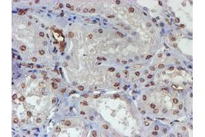 Immunohistochemical staining of paraffin-embedded Human Kidney tissue using anti-ELK3 mouse monoclonal antibody.