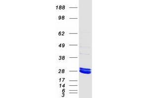Validation with Western Blot (MMAB Protein (Myc-DYKDDDDK Tag))