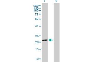 Western Blot analysis of SYT16 expression in transfected 293T cell line by SYT16 MaxPab polyclonal antibody. (SYT16 Antikörper  (AA 1-203))