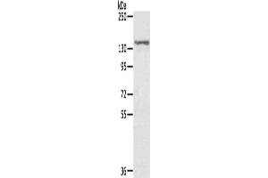 Gel: 6 % SDS-PAGE, Lysate: 40 μg, Lane: MCF7 cells, Primary antibody: ABIN7131203(STAG2 Antibody) at dilution 1/300, Secondary antibody: Goat anti rabbit IgG at 1/8000 dilution, Exposure time: 5 seconds (STAG2 Antikörper)