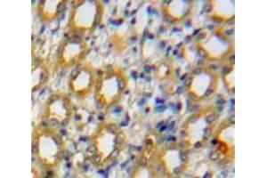 Used in DAB staining on fromalin fixed paraffin-embedded Kidney tissue (ADAMTS1 Antikörper  (AA 476-614))