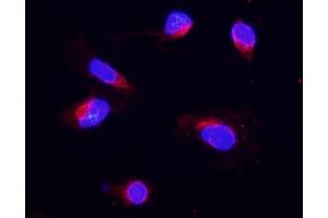 IF analysis of COX IV using anti-COX IV antibody (ABIN5692827).