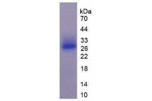 SDS-PAGE analysis of Mouse SOSTDC1 Protein.