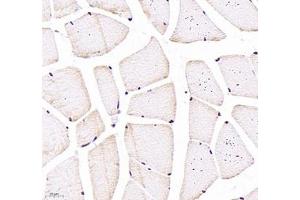 Immunohistochemistry of paraffin embedded rat skeletal muscle using CNG1 (ABIN7073608) at dilution of 1:700 (400x lens) (CNGA1 Antikörper)