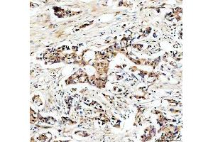 IHC analysis of USP5 using anti-USP5 antibody (ABIN7599551). (USP5 Antikörper  (AA 1-800))