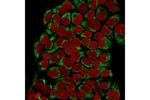 Immunofluorescence Analysis of Human MCF-7 cells labeling GnRH-R with GnRH-Receptor Mouse Monoclonal Antibody (F1G4) followed by Goat anti-mouse IgG-CF488 (Green). (GNRHR and LHCGR (AA 1-29), (N-Term) Antikörper)