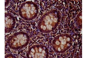 Immunohistochemistry (IHC) image for anti-Protein tyrosine Phosphatase Type IVA, Member 2 (PTP4A2) (AA 1-164) antibody (ABIN7166237)