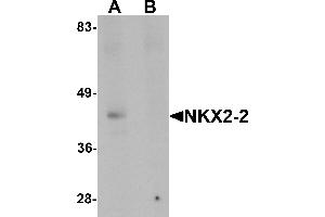 Western blot analysis of NKX2-2 in rat kidney tissue lysate with NKX2-2 antibody at 1 µg/mL in (A) the absence and (B) the presence of blocking peptide.