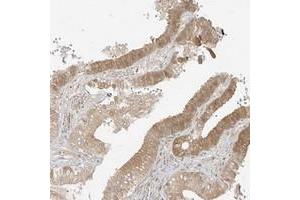 Immunohistochemical staining of human gallbladder with LIPT1 polyclonal antibody  shows moderate cytoplasmic positivity in glandular cells. (LIPT1 Antikörper)