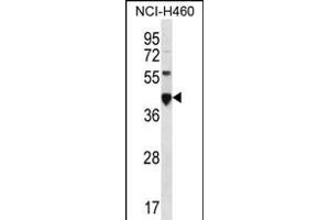 CEAC Antibody (N-term) (ABIN656216 and ABIN2845533) western blot analysis in NCI- cell line lysates (35 μg/lane). (CEACAM18 Antikörper  (N-Term))