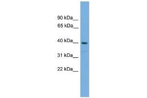 SAMSN1 antibody used at 1 ug/ml to detect target protein. (SAMSN1 Antikörper  (Middle Region))